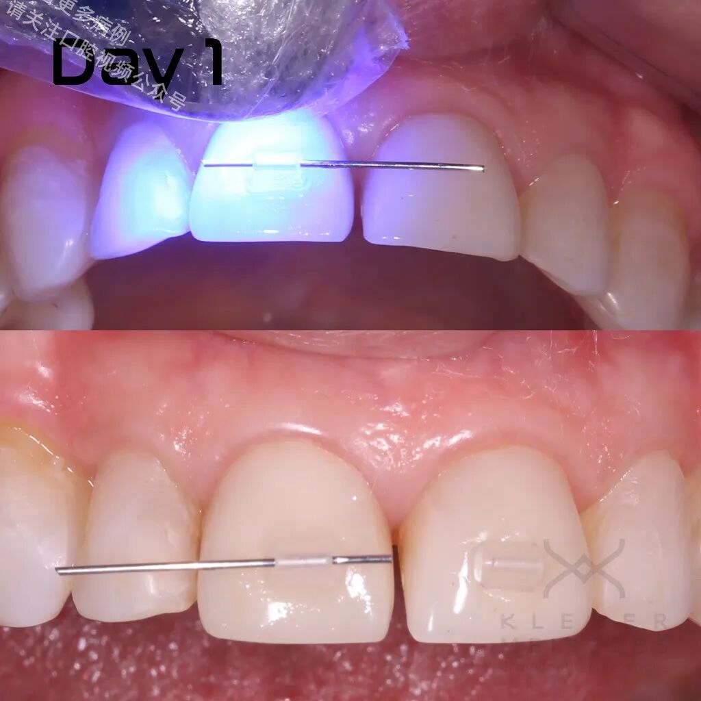 关闭间隙，还能这样做？