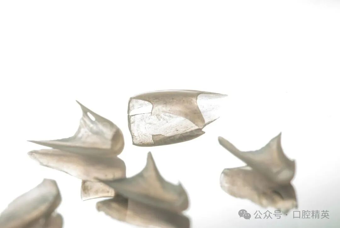 下前牙关闭间隙；不备牙瓷贴面修复