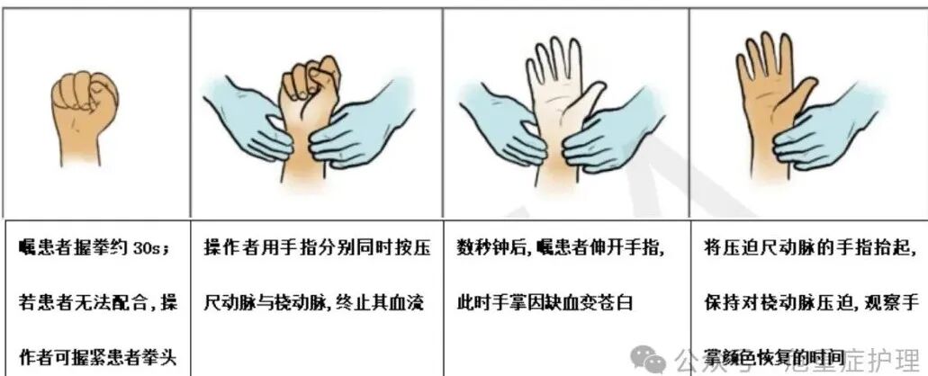 经桡动脉及远端桡动脉穿刺技术，干货满满！