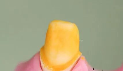 如何采用硅橡胶快速去除戴牙支点