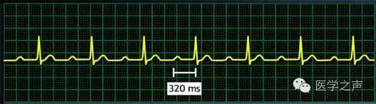 常见心律失常的急诊处理（心血管医生值班必备）