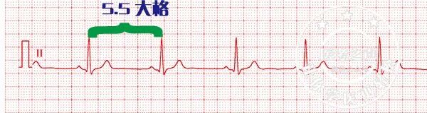 常见心律失常的急诊处理（心血管医生值班必备）