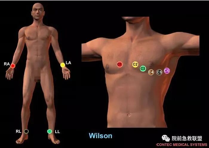 常见心律失常的急诊处理（心血管医生值班必备）