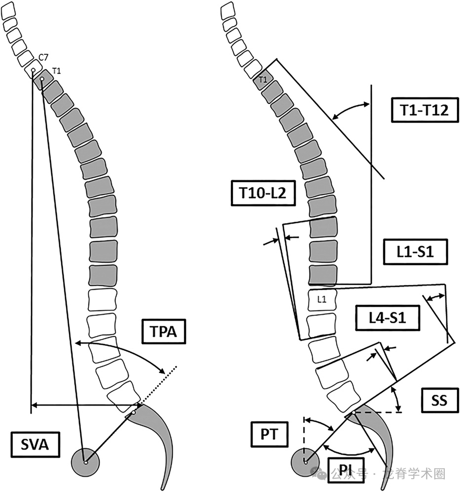 ​《JBJS》：腰椎退行性疾病中的矢状位平衡
