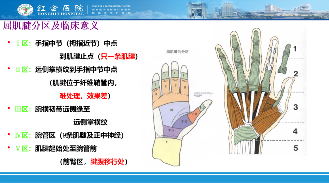 骨科实战：手外伤急诊处理原则精要