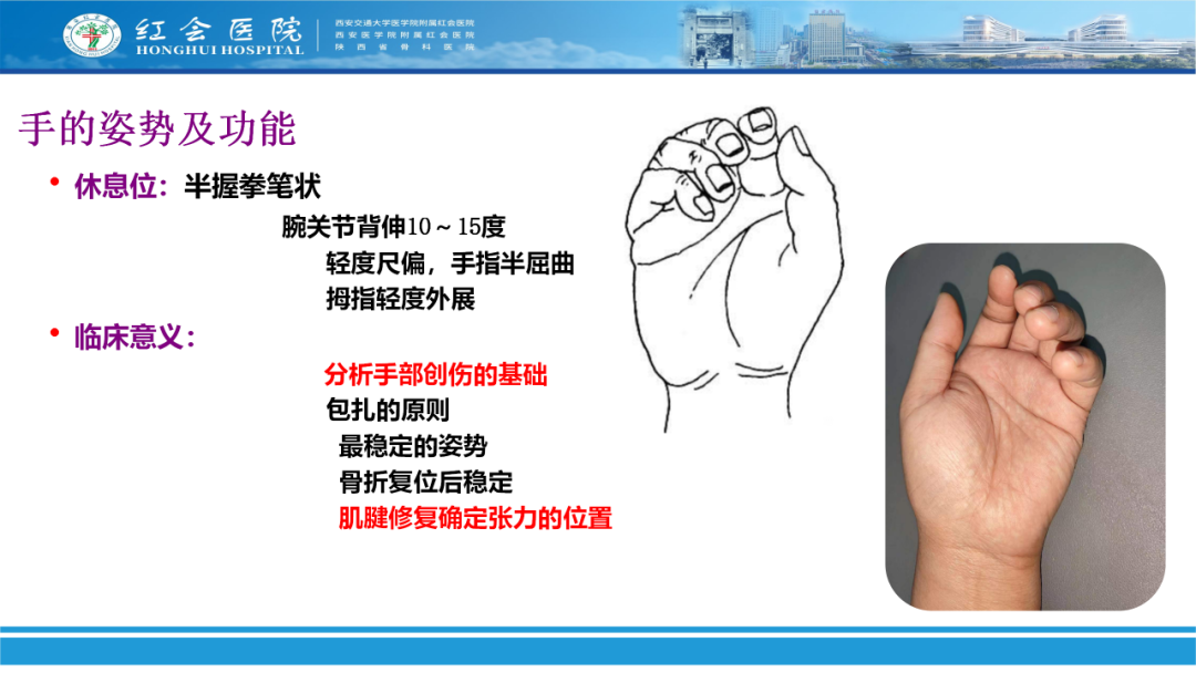 骨科实战：手外伤急诊处理原则精要