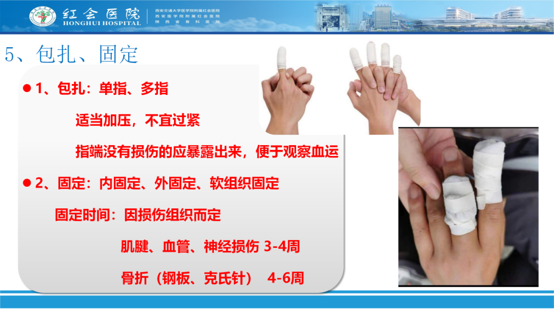 骨科实战：手外伤急诊处理原则精要