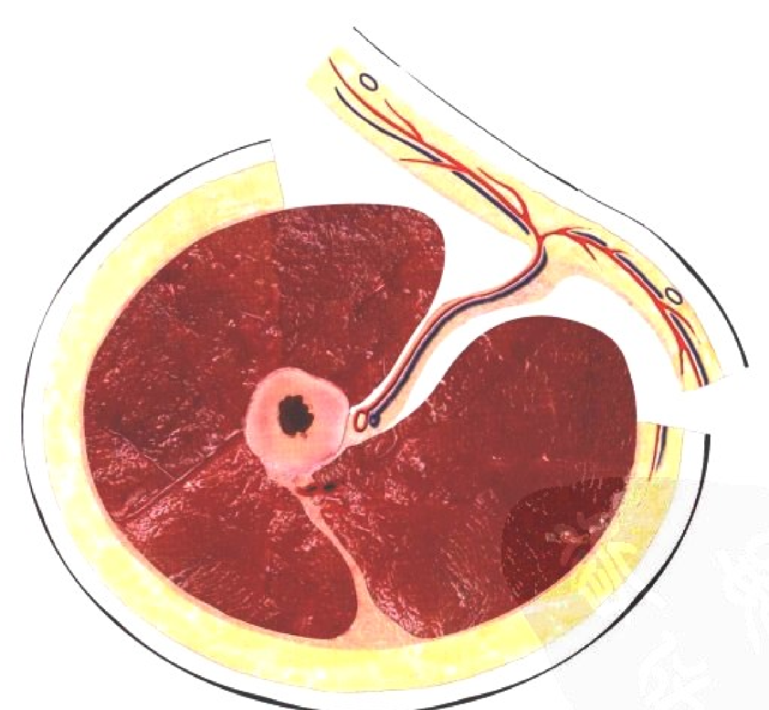 皮瓣的设计及切取要点