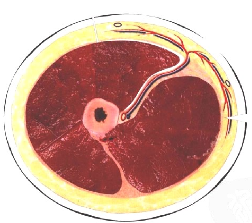 皮瓣的设计及切取要点