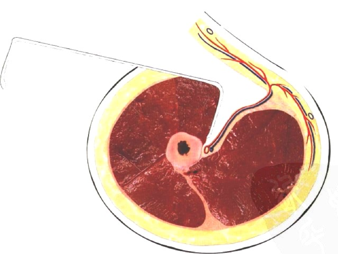 皮瓣的设计及切取要点
