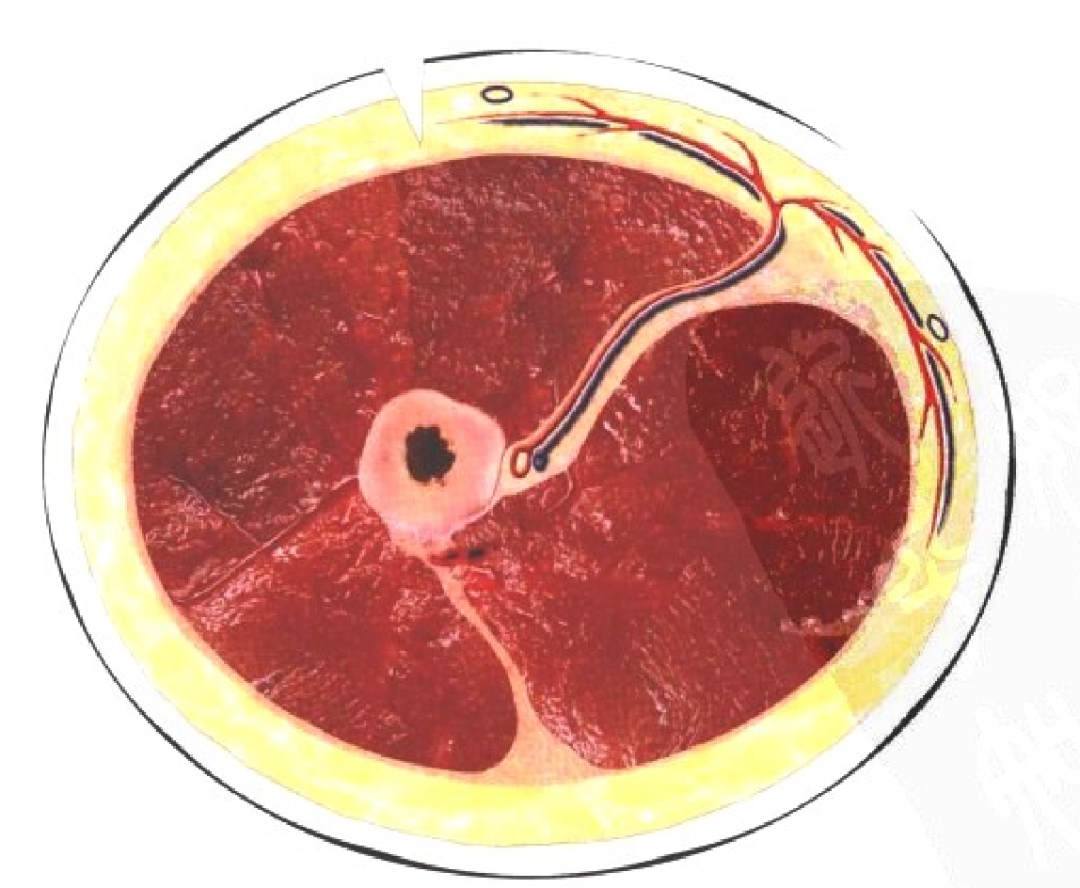 皮瓣的设计及切取要点