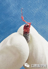 忘调转速，植体撕裂神经