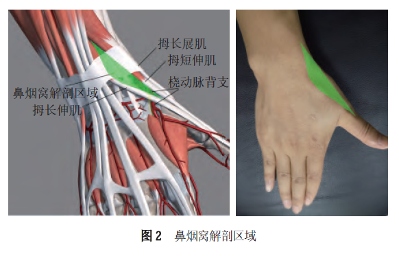 经桡动脉及远端桡动脉穿刺技术，干货满满！