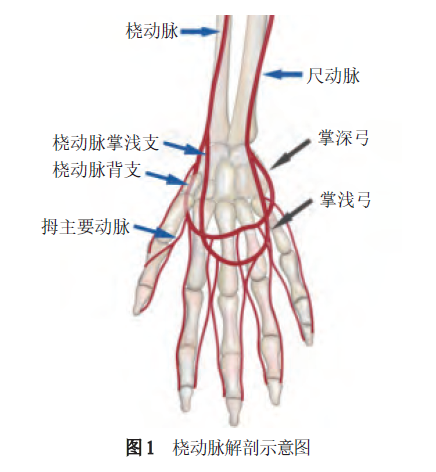 经桡动脉及远端桡动脉穿刺技术，干货满满！