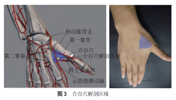 经桡动脉及远端桡动脉穿刺技术，干货满满！