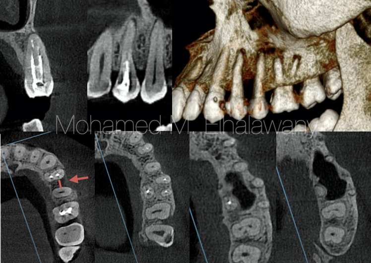 【病例报告】没拍片，误诊误治7个月