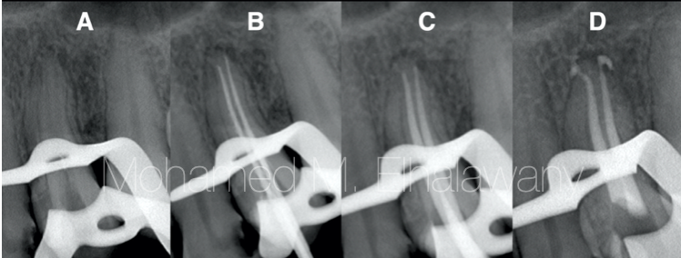 【病例报告】没拍片，误诊误治7个月