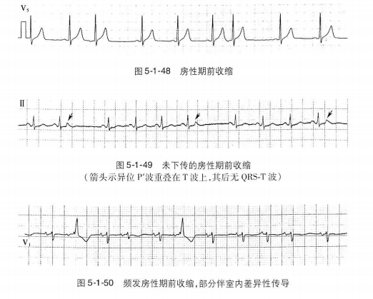 常见心律失常的急诊处理（心血管医生值班必备）